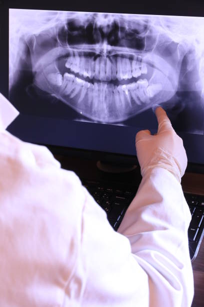 Best Knocked-Out Tooth (Avulsed Tooth) Treatment in Edwards, MS